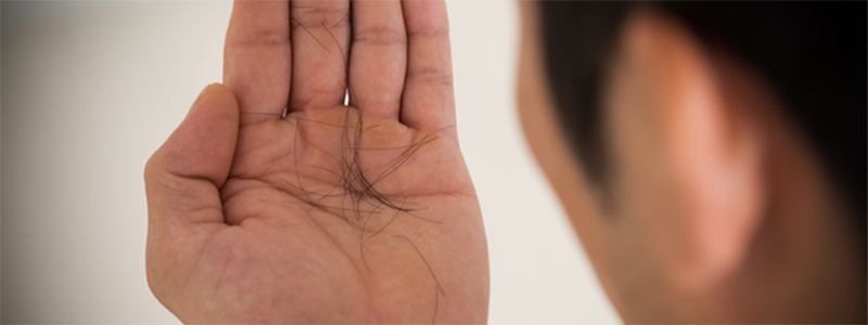 男性の抜け毛対策 男性ホルモンやシャンプーがハゲる薄毛の原因